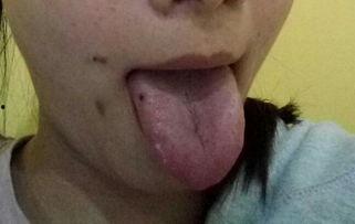 吃瓜没洗舌头疼,揭秘口腔健康小常识