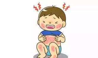 吃瓜能引起湿疹